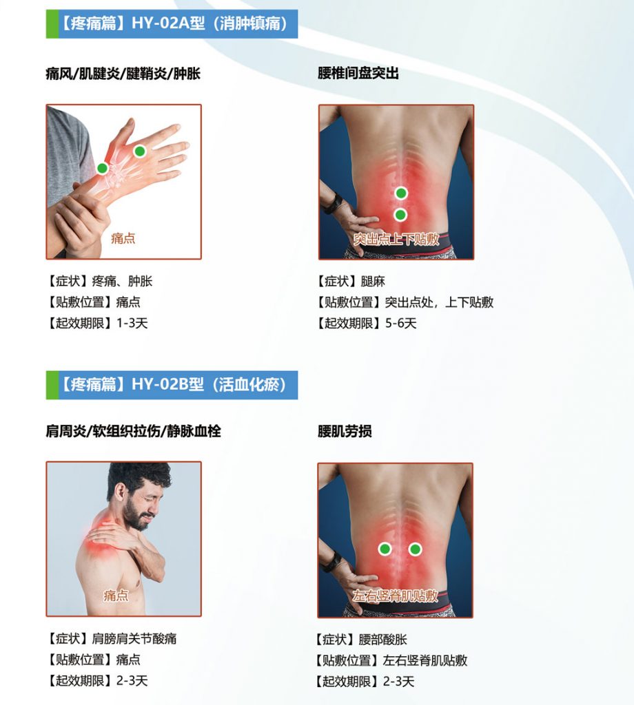 中芯生物一次性使用超聲治療墊片貼敷使用方法圖示