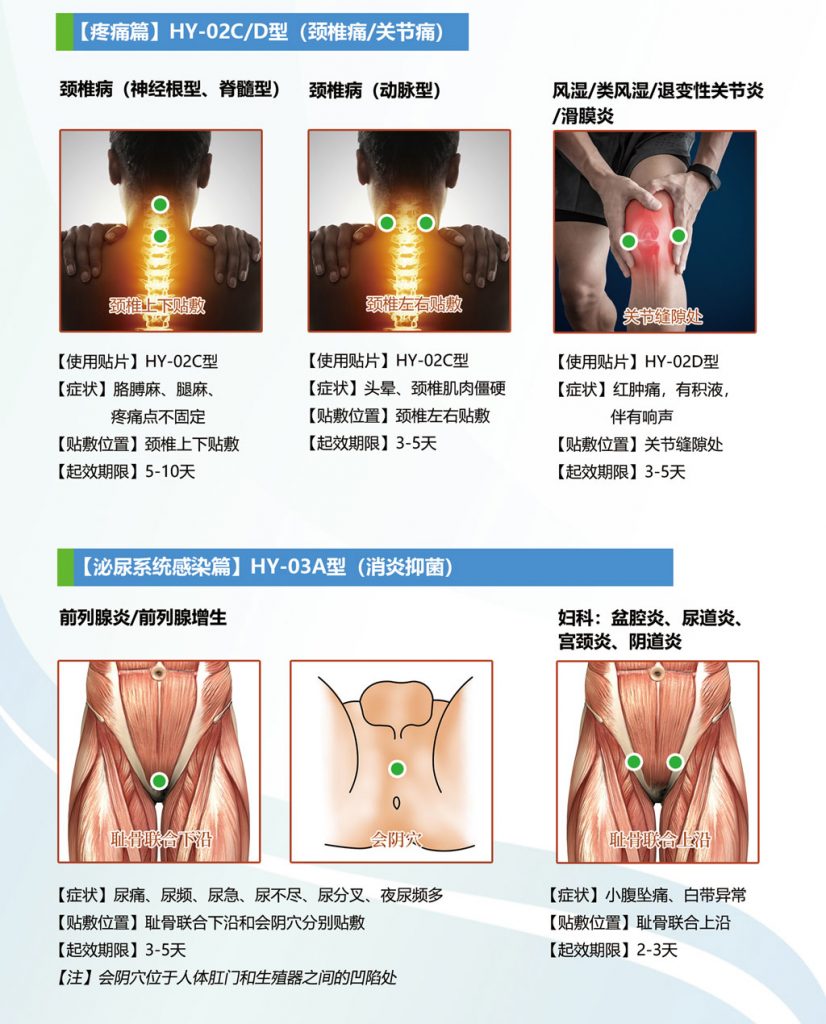 中芯生物一次性使用超聲治療墊片貼敷使用方法圖示
