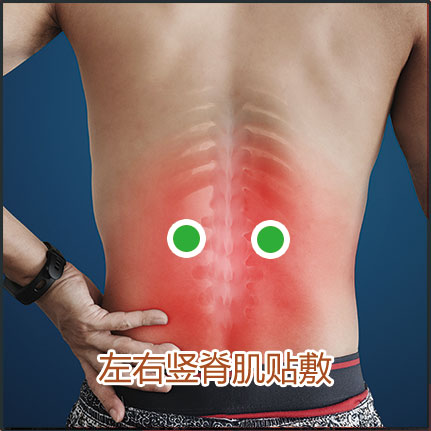 腰肌勞損貼敷位置示意圖